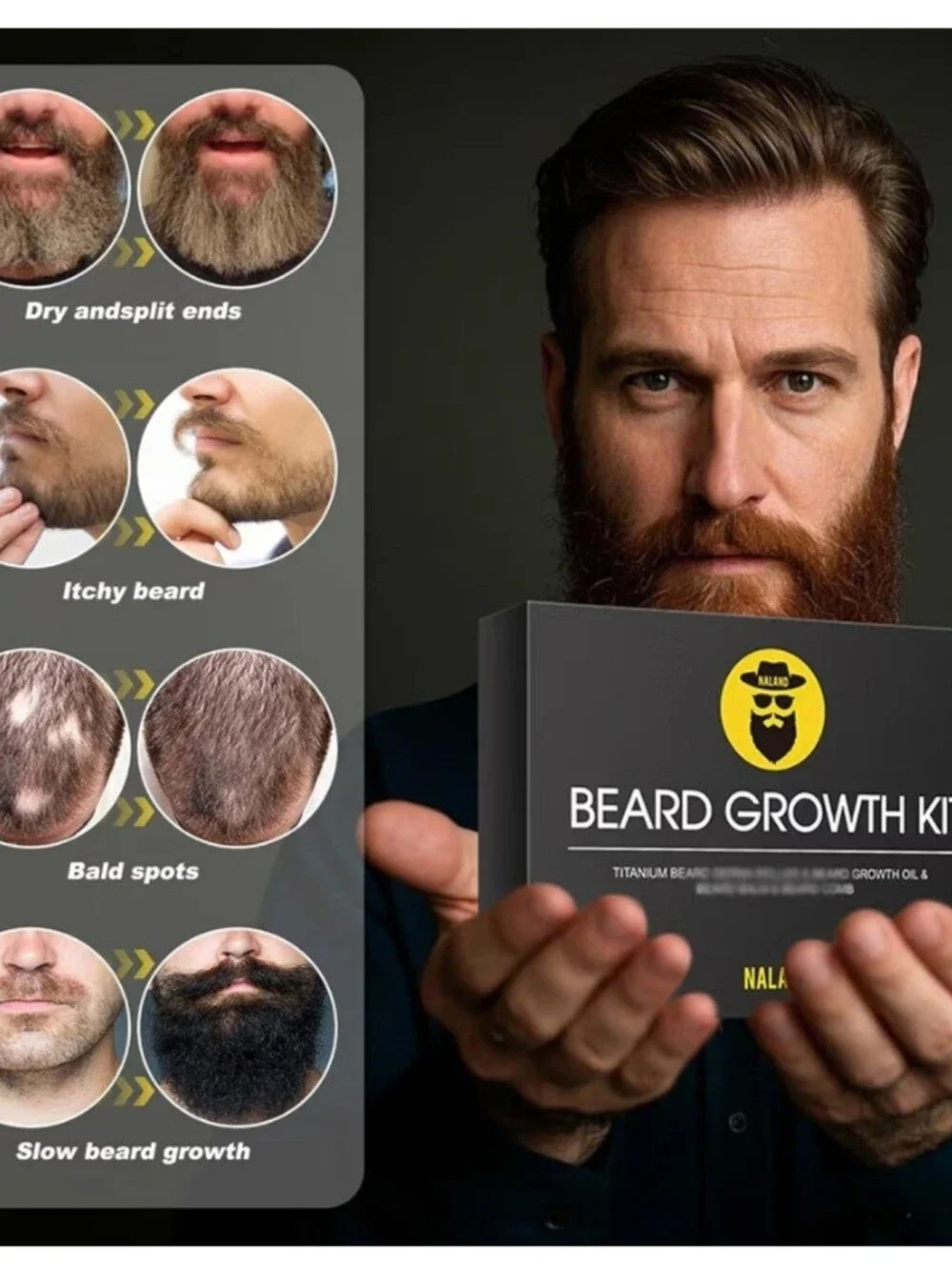 BRAND NEW Sealed Naland Beard Growth Kit